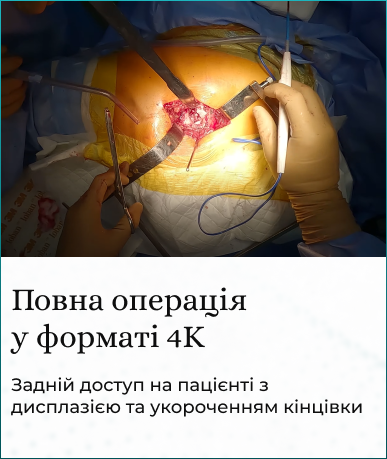 bez_krapki_2